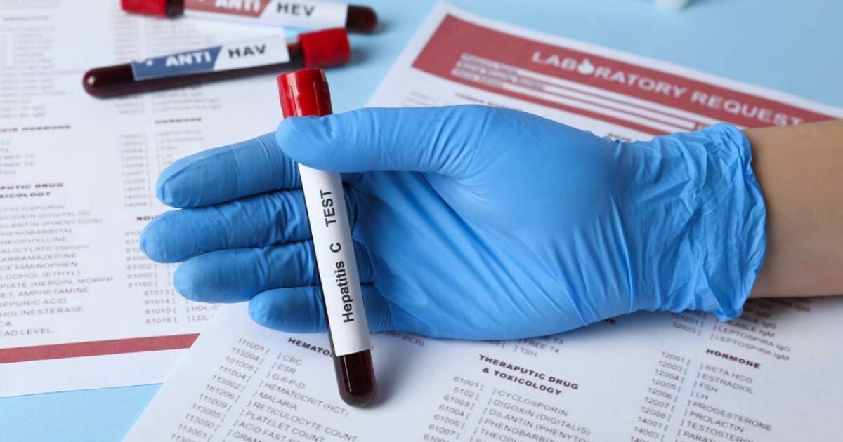 SPKC aicina bez maksas veikt B un C hepatīta pārbaudes