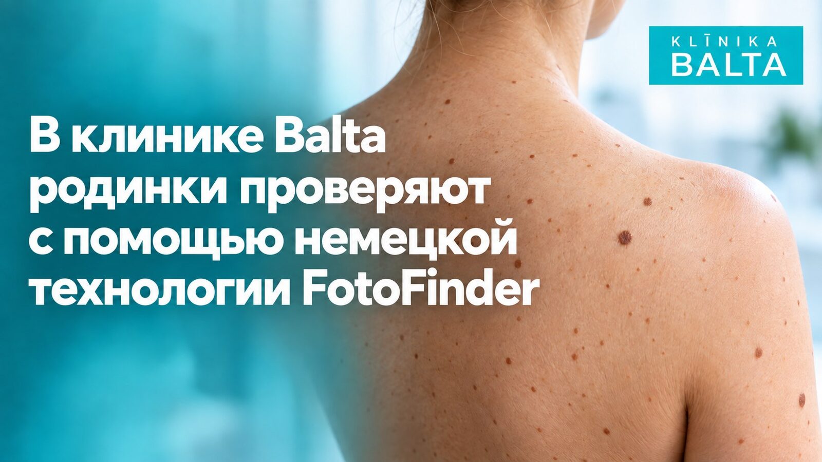 В клинике Balta родинки проверяют с помощью немецкой технологии FotoFinder