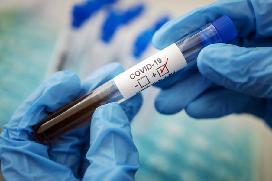 COVID-19: переболевшие способны выделять вирус до трех месяцев