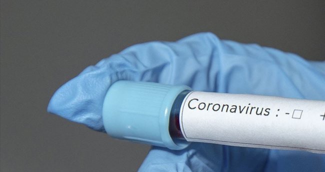 Covid-19: Польша - больницы в поле, Словения - сами ищите контактные лица