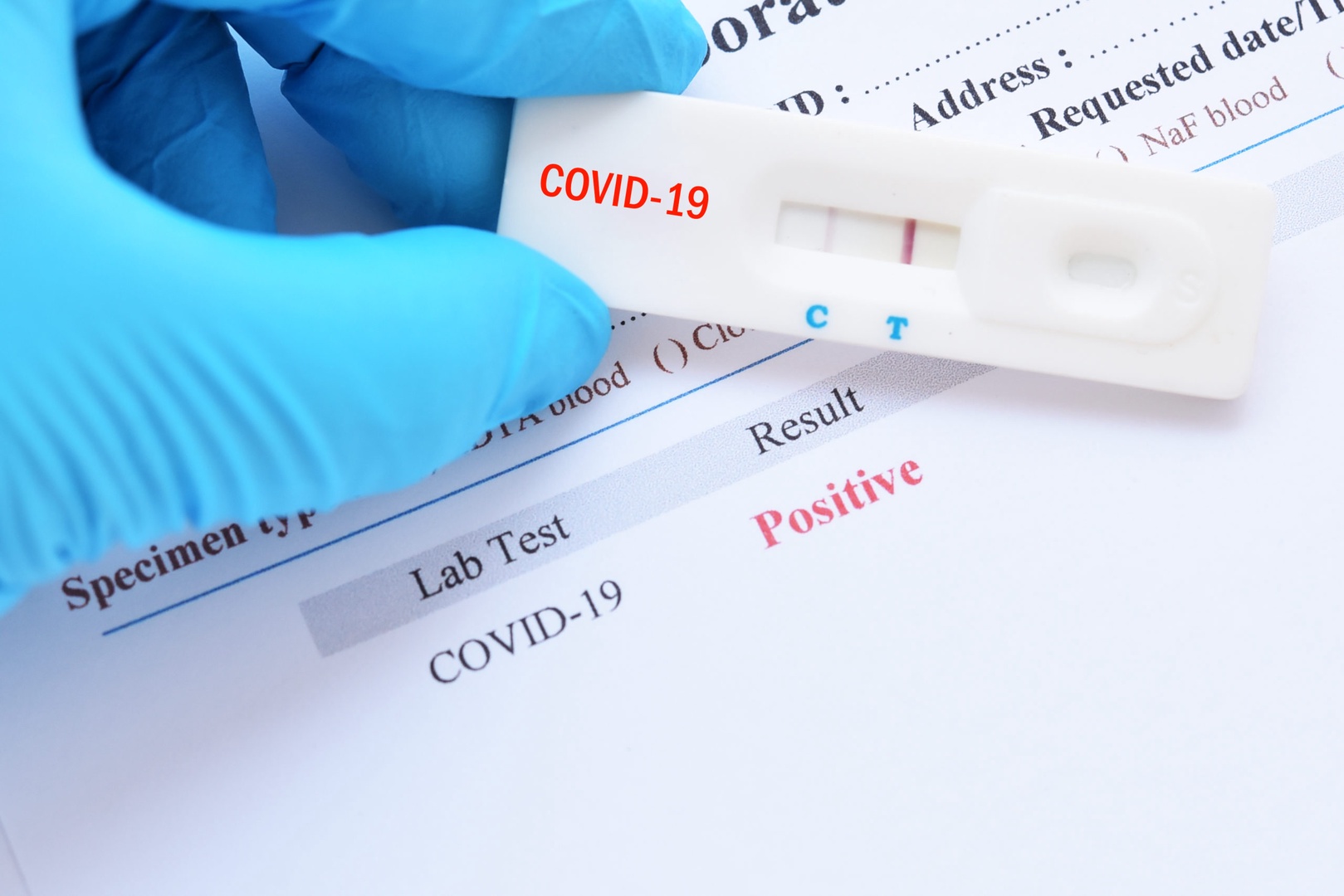 Covid-19: Еврокомиссия выделила сто миллионов евро на экспресс-тесты