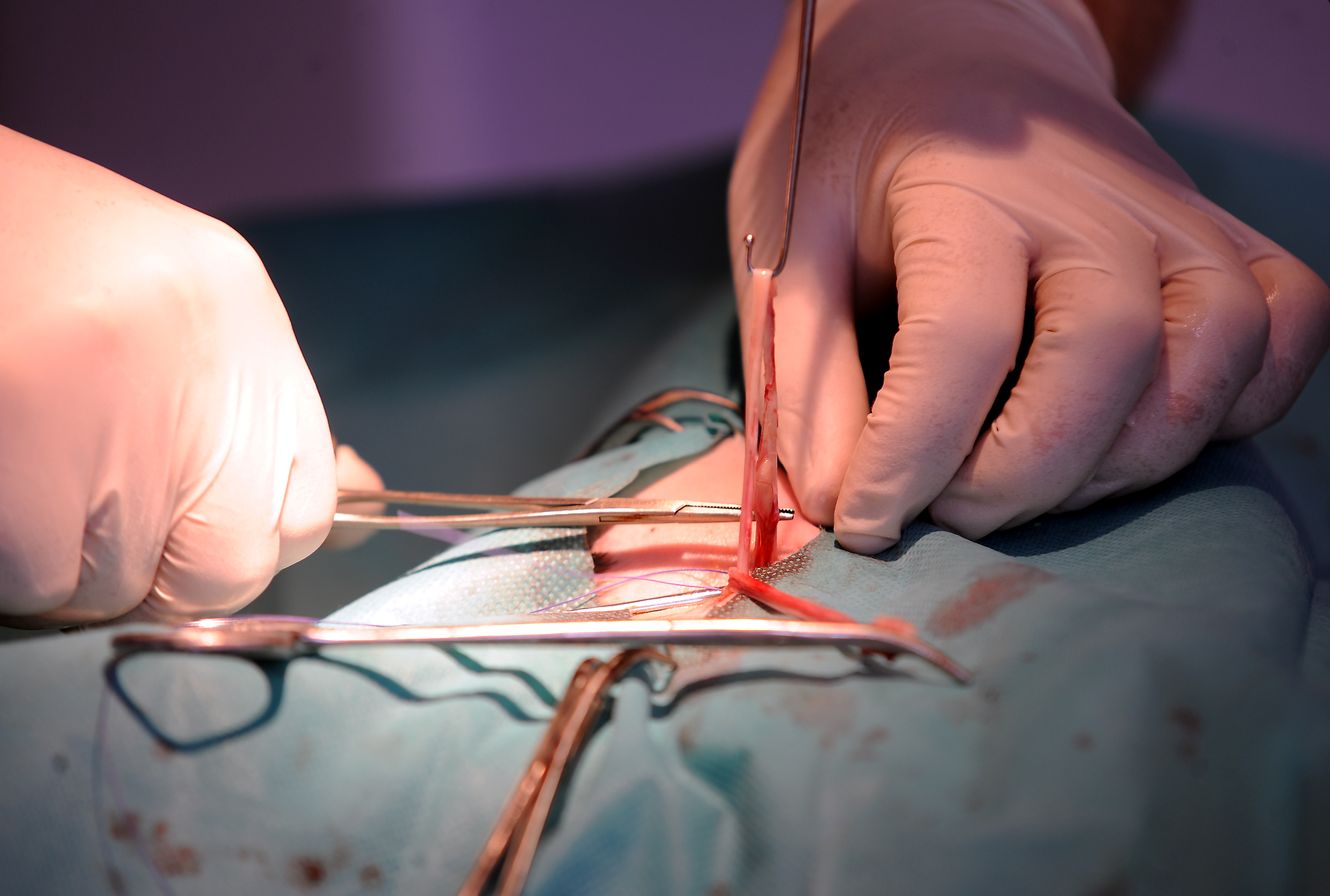 Liepājas slimnīcā pirmo reizi veica sirds stimulatoru implantēšanas operācijas