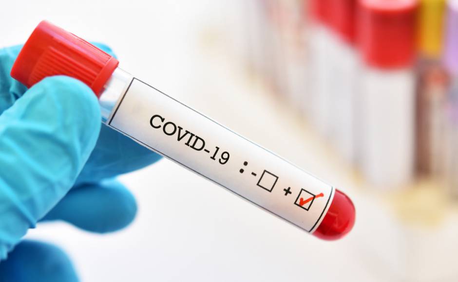 "Covid-19": 1429 заражений за сутки