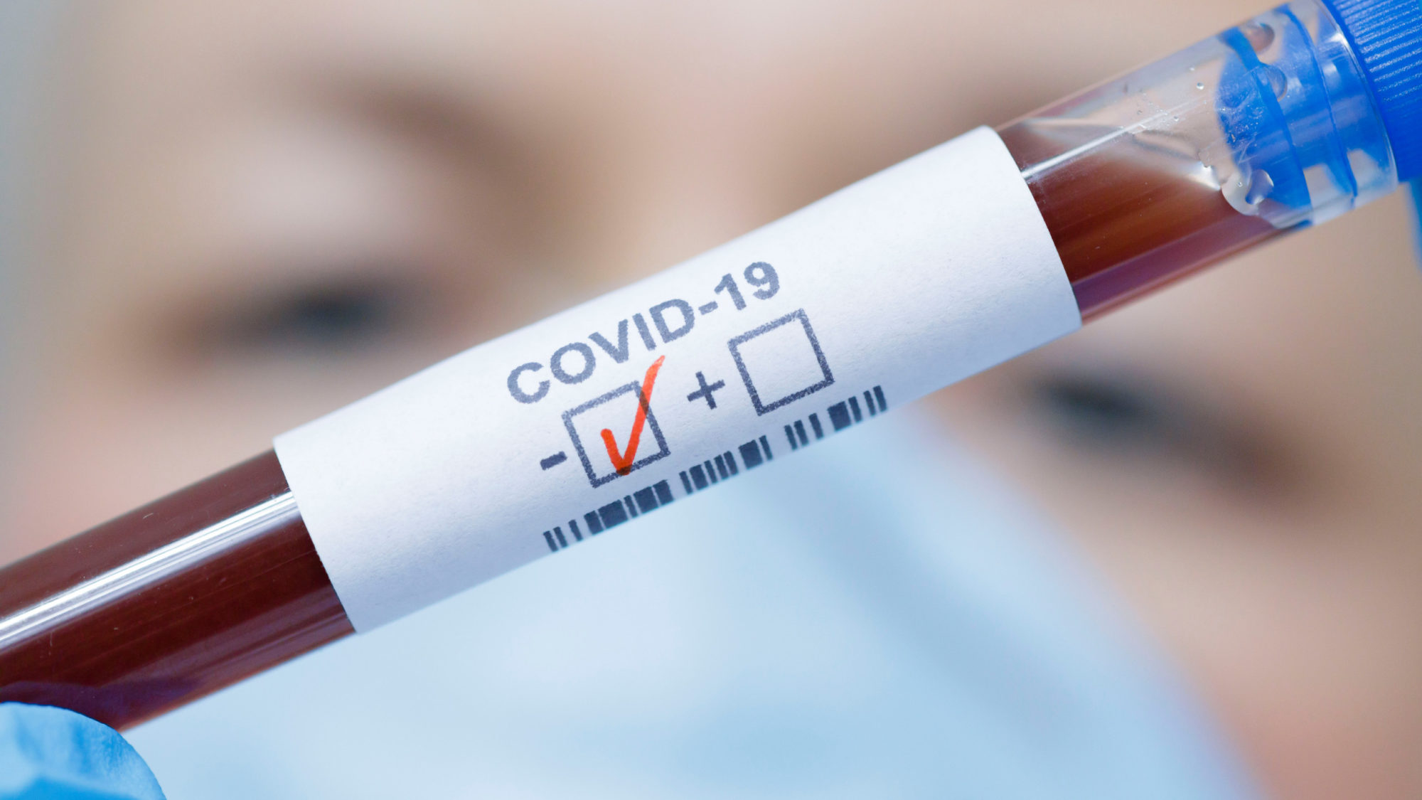 Covid-19: в Эстонии 490 новых случаев , а в Литве - 1032