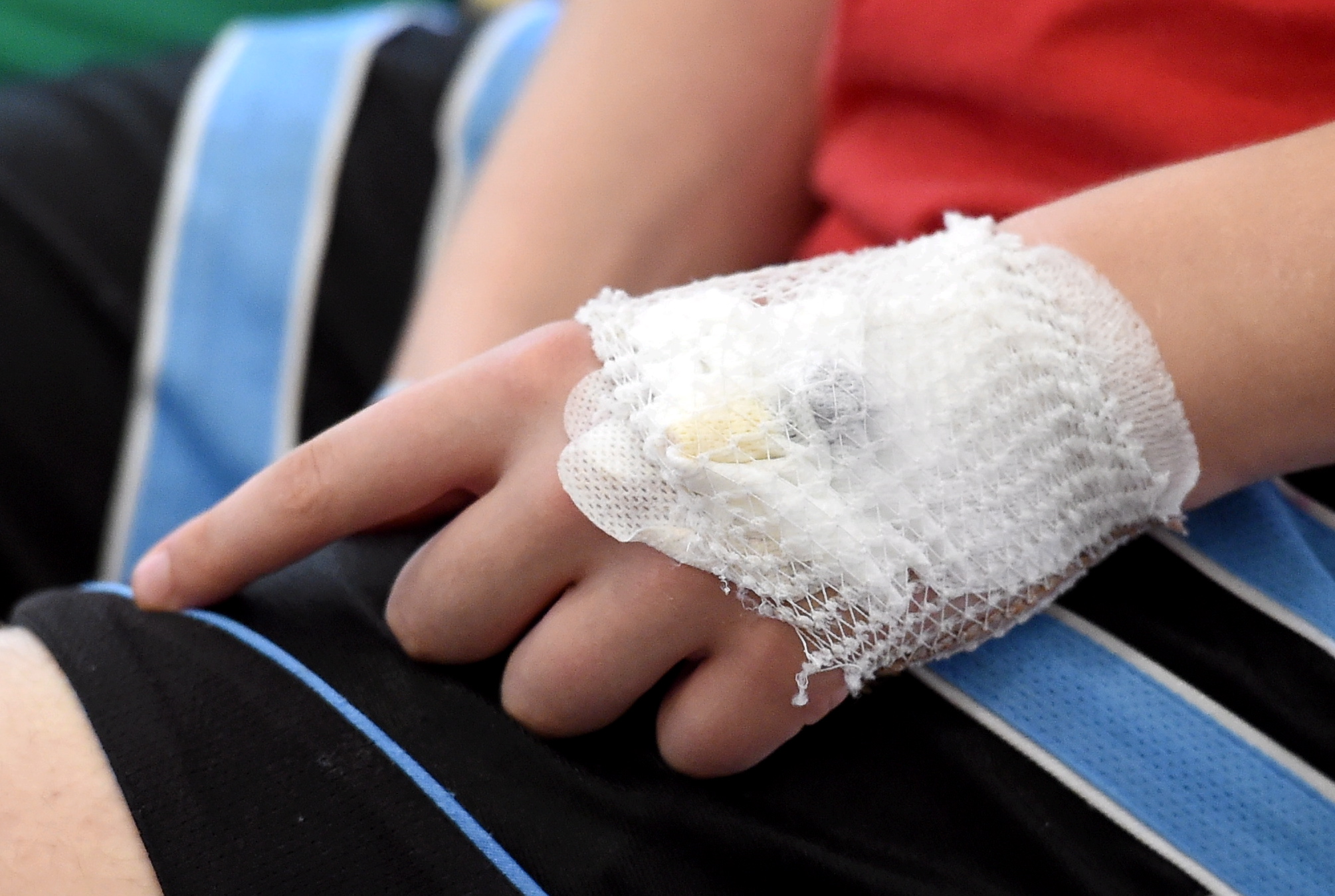 Baudot ziemas priekus, nedēļas nogalē traumas guvuši 110 bērni
