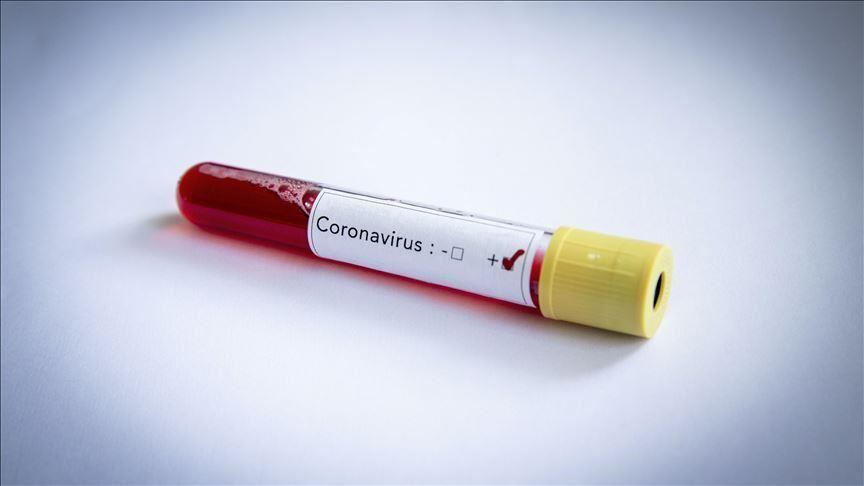 Covid-19: в Эстонии 1308 новых случаев, в Литве - 462