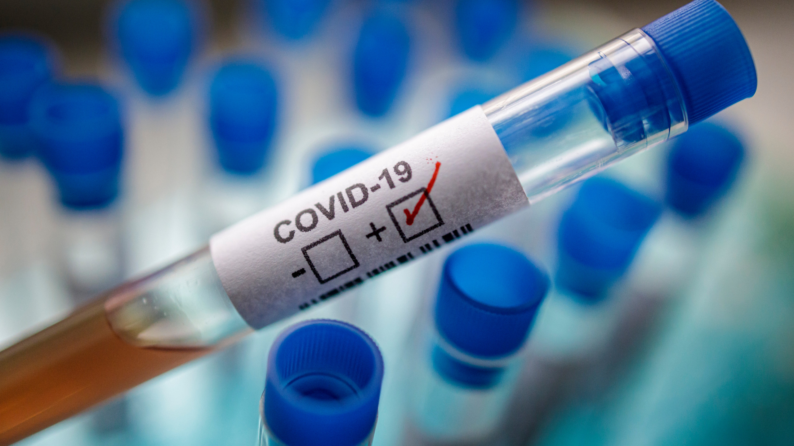 В Литве самоизоляция обязательна только после контакта с болеющим Covid-19 в семье