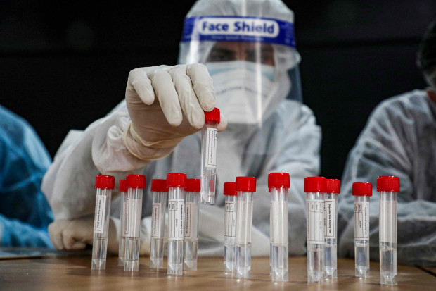 Вакцину Pfizer начали испытывать на беременных