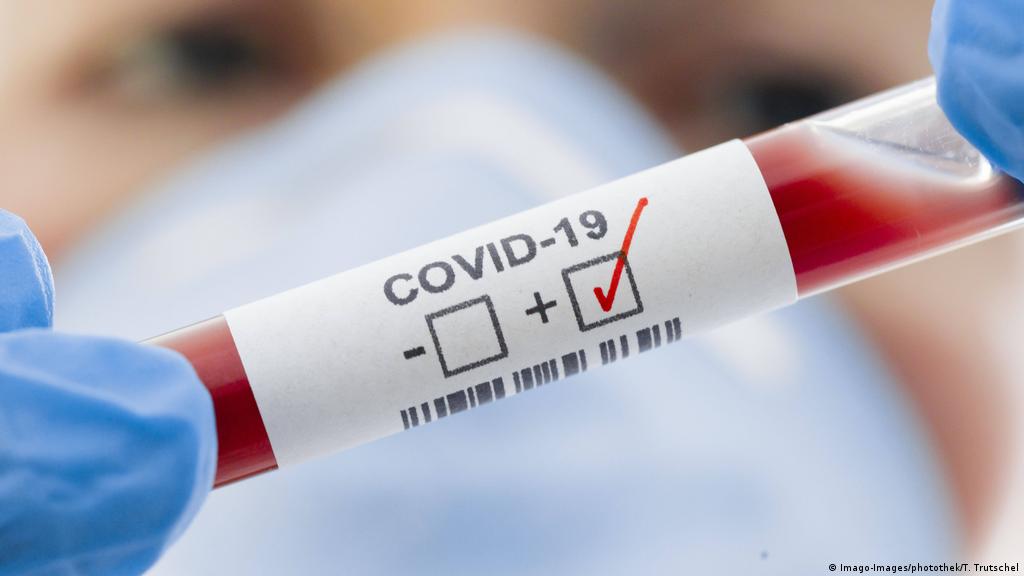 Подтверждено 1314 новых случаев "Covid-19", умерли семь человек