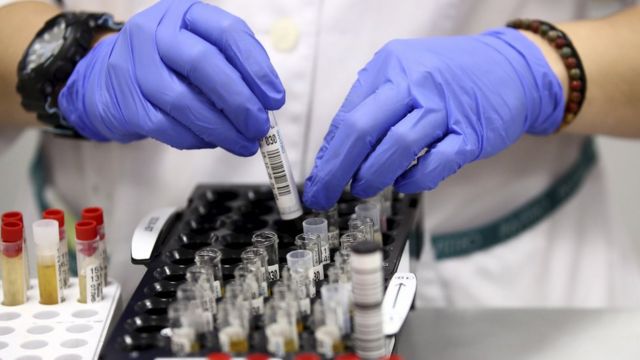 Подтверждено 211 новых случаев "Covid-19". Два человека скончались